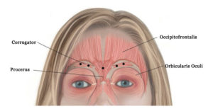 xMuscular structure of the forehead and Xeomin injection sites