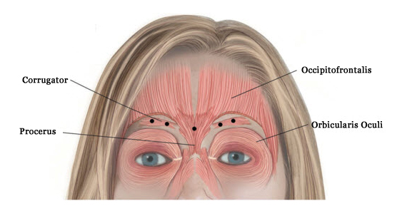 Muscular structure of the forehead and Xeomin injection sites