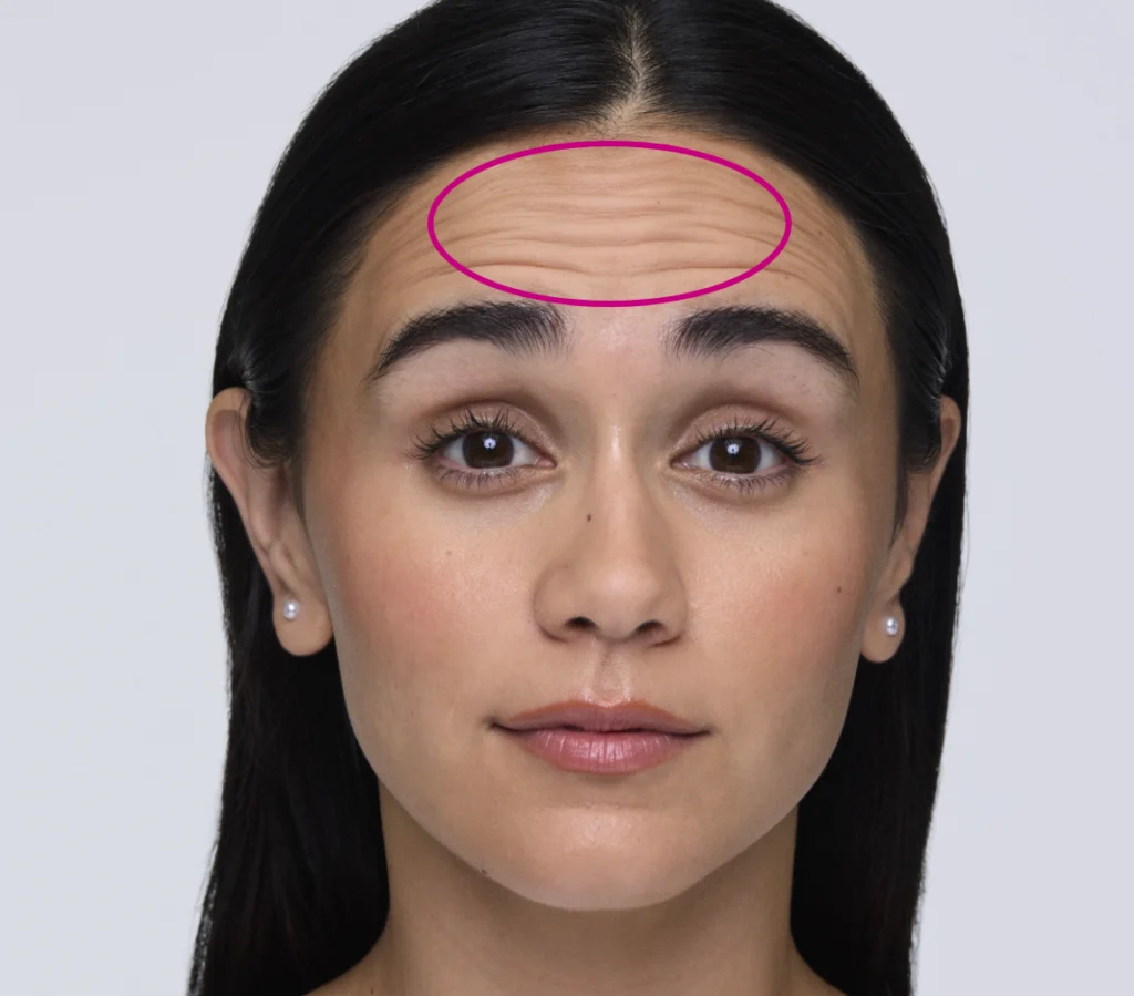 Woman raising her eyebrows to show forehead lines with a pink circle around them
